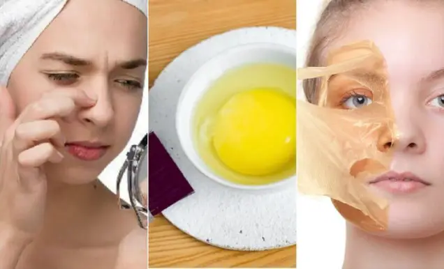 Máscara de huevo blanco eficaz para una piel sana y brillante