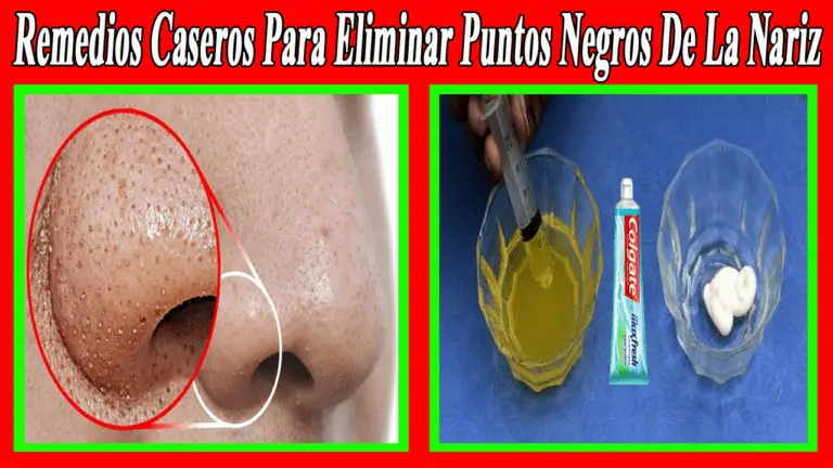 Remedios Caseros Para Eliminar Puntos Negros De La Nariz Hoy En Belleza