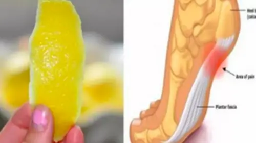 Una cáscara de limón puede quitar el dolor de las articulaciones para siempre