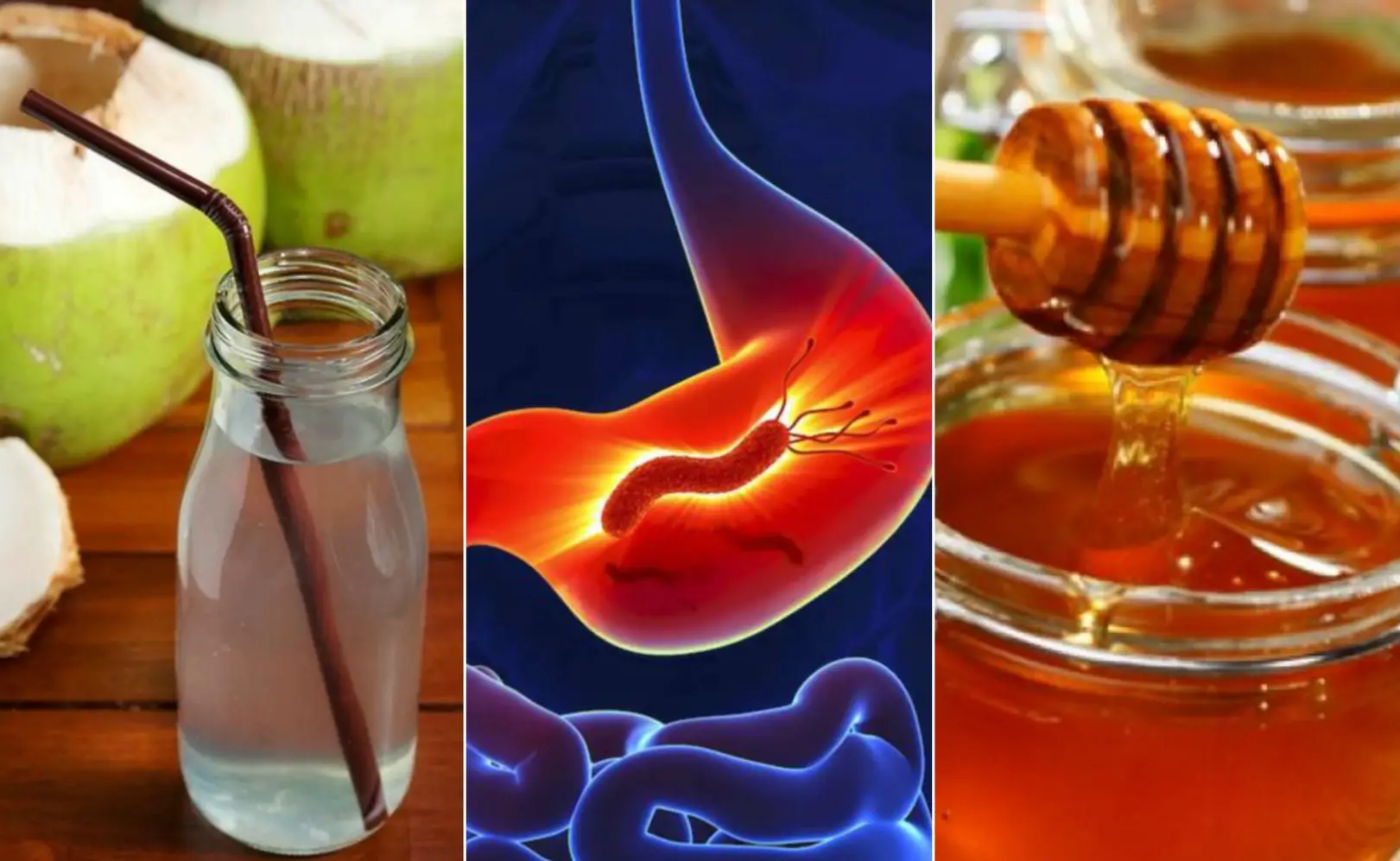 Los mejores remedios naturales para las úlceras y la gastritis