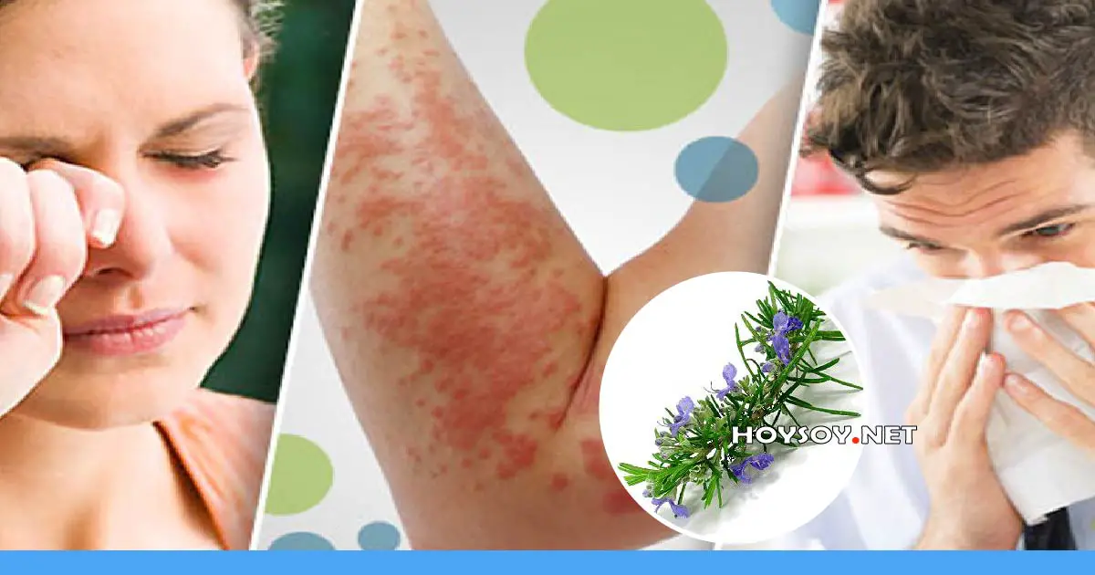 5 remedios herbales para calmar las alergias de la piel