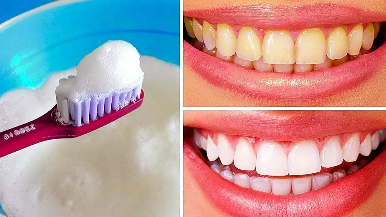 Pasta dental casera para blanquear los dientes y fortalecer las encías