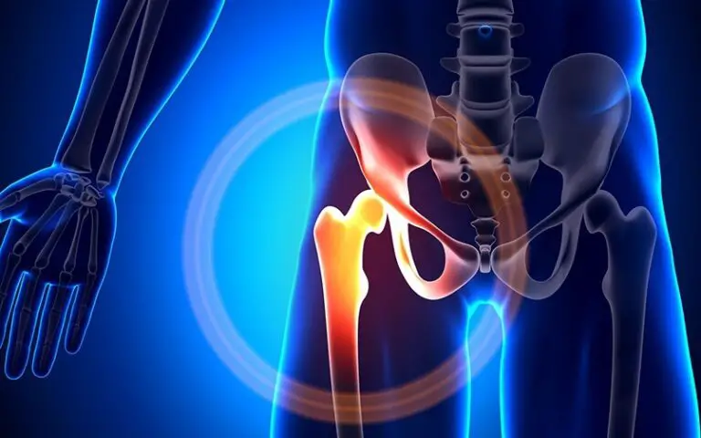 Los 10 Mejores Remedios Caseros Para Tratar La Bursitis Hoy En Belleza los-10-mejores-remedios-caseros-para-tratar-la-bursitis-hoy-en-belleza