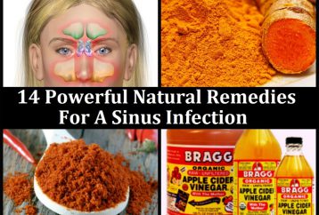 14 poderosos remedios naturales para una infección de los senos nasales
