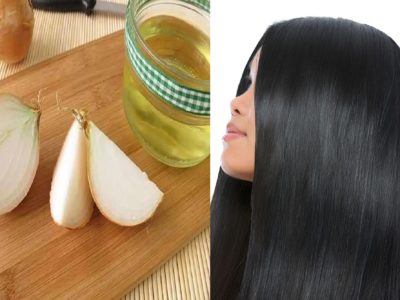 ¿Cómo utilizar el jugo de cebolla para la pérdida y el crecimiento del cabello?