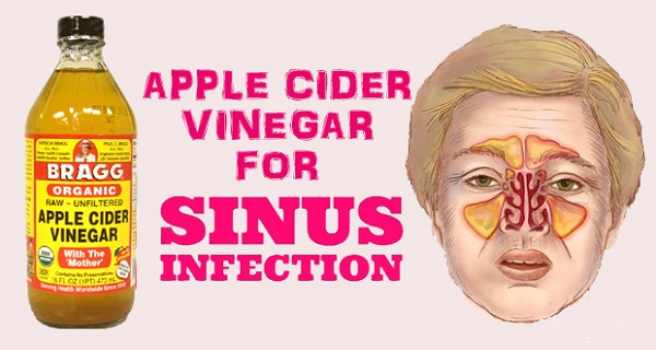 6 formas de usar vinagre de sidra de manzana para la infección de los senos nasales