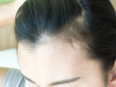 9 problemas y soluciones pertenecientes al cabello