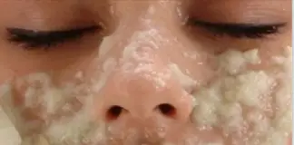 ¡Limpia las manchas oscuras de tu cara después de un segundo uso!
