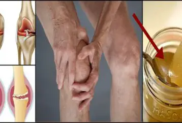 La raíz del dolor de rodilla es un daño del cartílago, ¡así que esta es la forma de regenerarlo naturalmente!