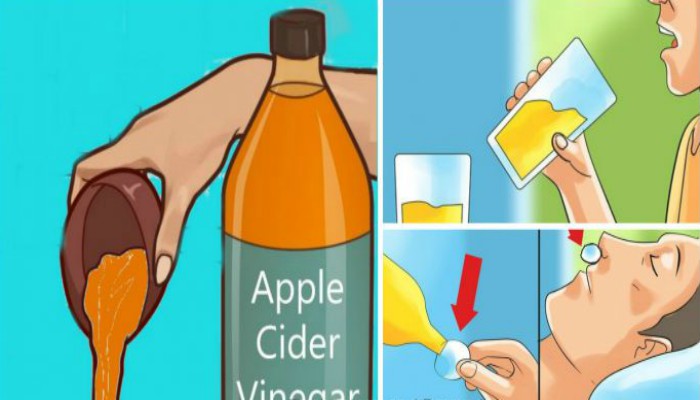 Beba vinagre de sidra de manzana antes de acostarse porque tratará estas condiciones de salud