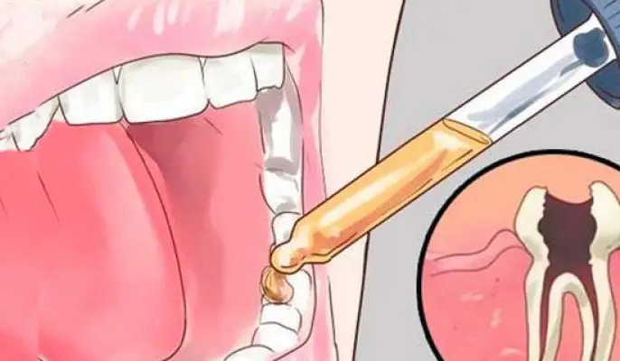 12 remedios naturales para el dolor de muelas que su dentista no quiere que usted sepa