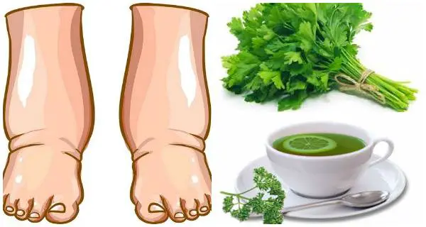 Este poderoso té casero curará las piernas hinchadas en pocos días
