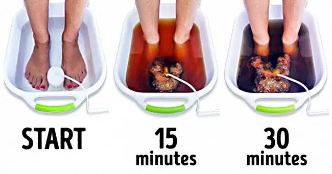 How to make a detox foot bath at home to flush out toxins