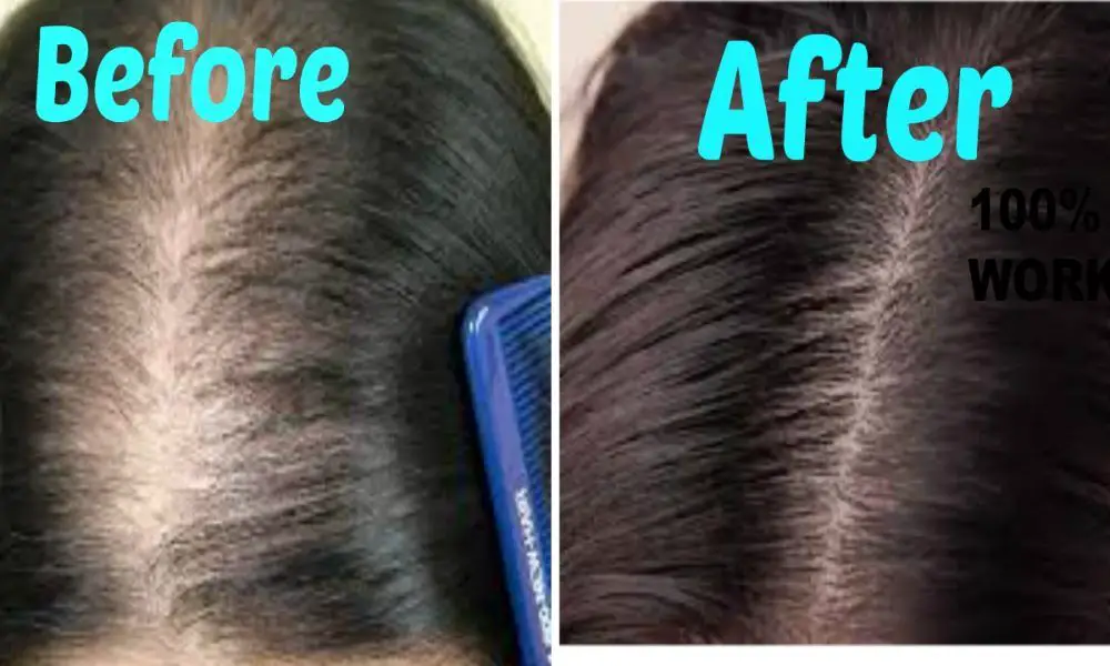 Natural shampoo to stop hair loss and stimulate hair growth