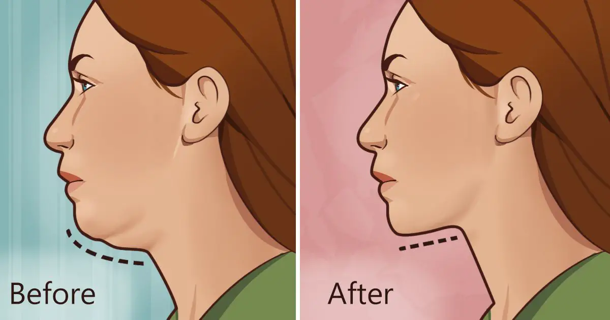 Natural method to eliminate double chin in a simple way