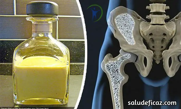 Remedio casero de licor de huevo para la osteoporosis y la artritis