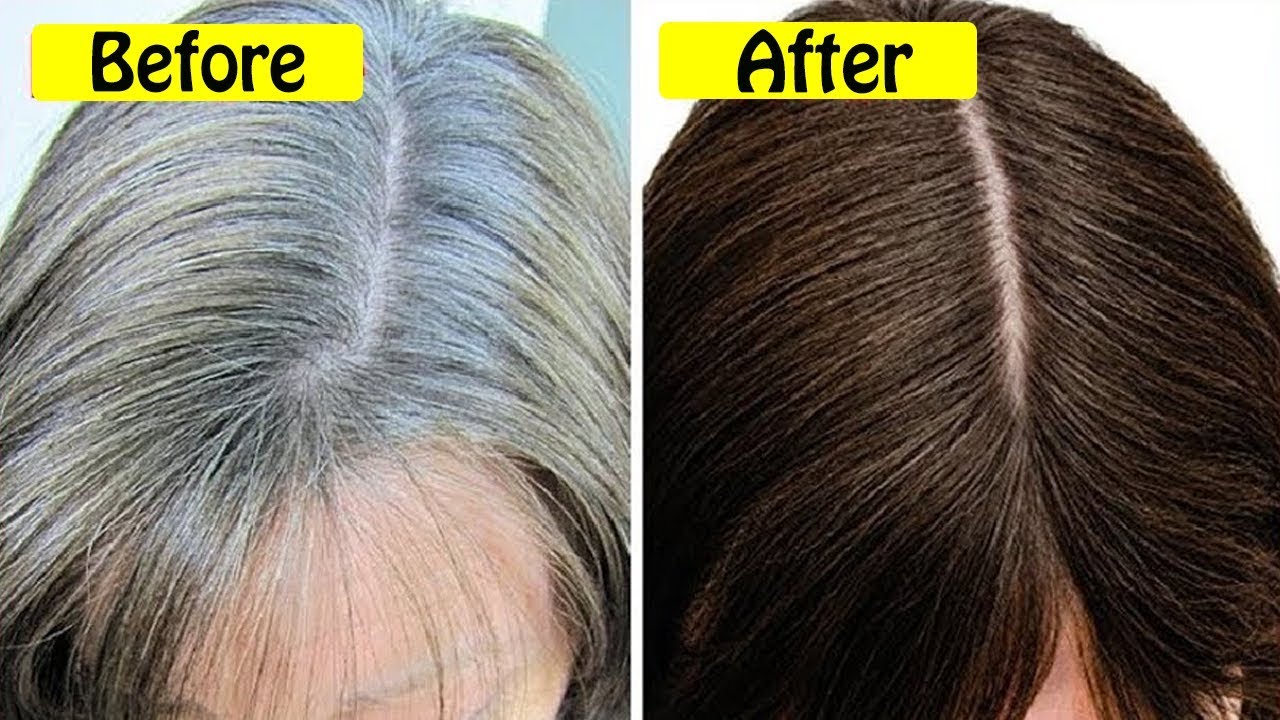 Home remedy to get rid of white hair