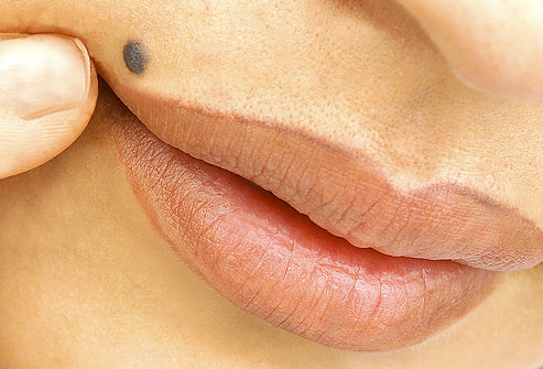 If You Have A Mole At One Of These 7 Places On Your Body, You Will Be Surprised What It Means!