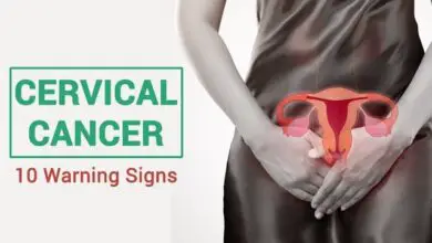 10 Warning Signs Of Cervical Cancer You Should Not Ignore