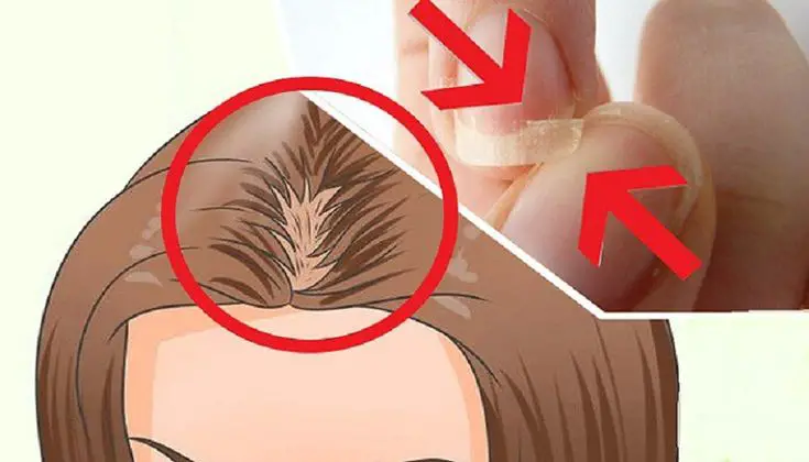 What You Should Do About Hair Loss and Brittle Nails Treatment