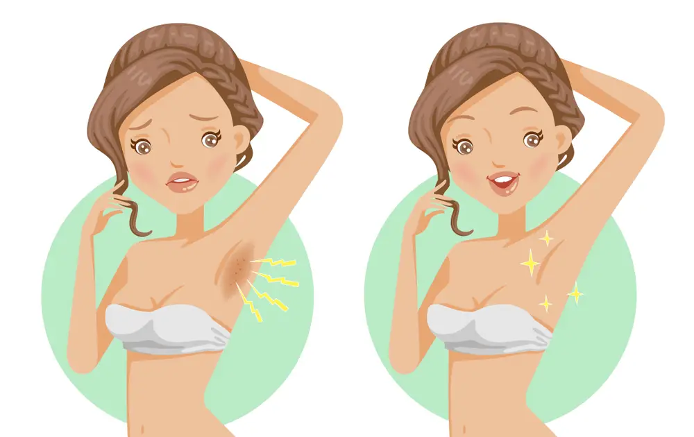 Get Perfect Armpits With These Homemade Remedies